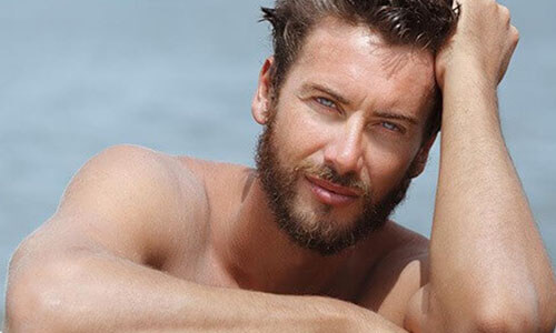 Close-up picture of a man,  happy with his hair transplant  procedure he had in San Jose, Costa Rica.  The man is shown leaning against the edge of a pool and looking directly at the camera with an arm raised to his head to feature his hair transplant.