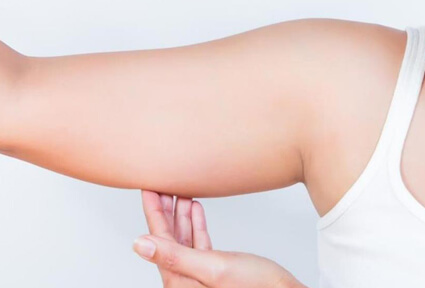 Picture of a woman facing the camera and happy with the perfect arms liposuction procedure she had at Top Plastic Surgeons in beautiful San Jose, Costa Rica.  She is wearing a white top and holding her hand to one arm,  showing the area of the surgery.